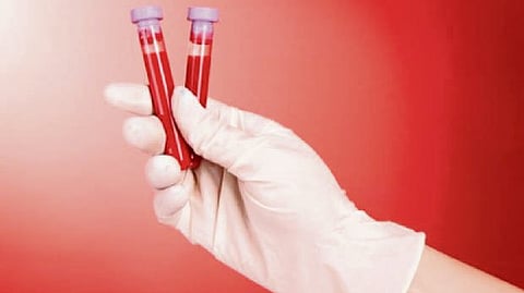 Representative image