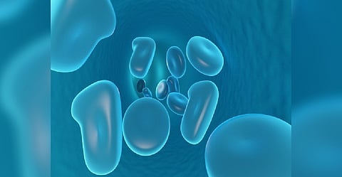 Representative Image