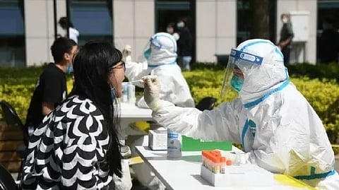 Representative image