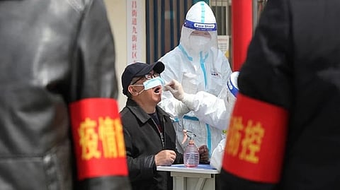 Representative image