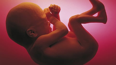 DT Health: Minimise risks of recurrent pregnancy loss