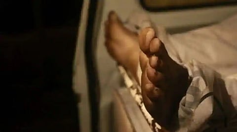 Representative image