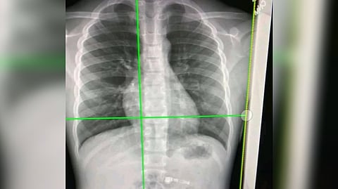 Representative image