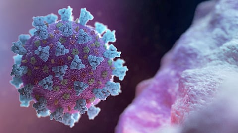 Representative image