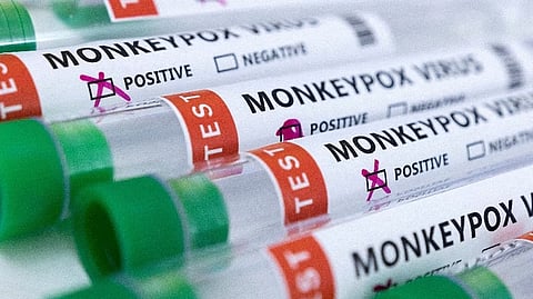 Representative image