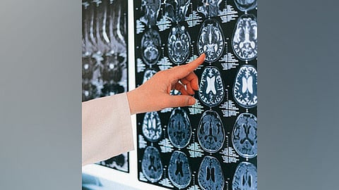 Representative Image