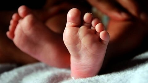 Representative image