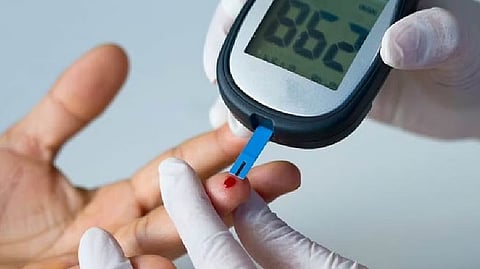 Representative image