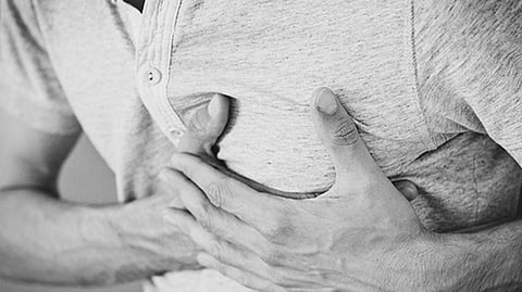 Representative Image