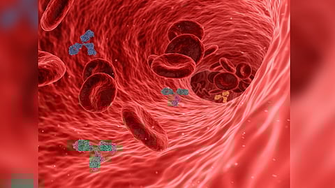 Representative image