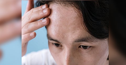 Representative Image