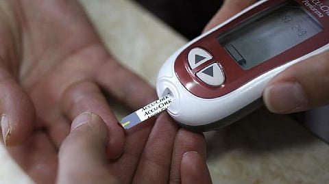 Representative Image