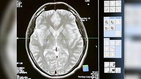 Representative image