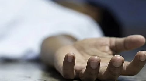 Representative image