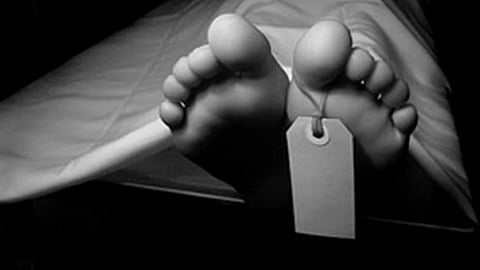 Representative Image