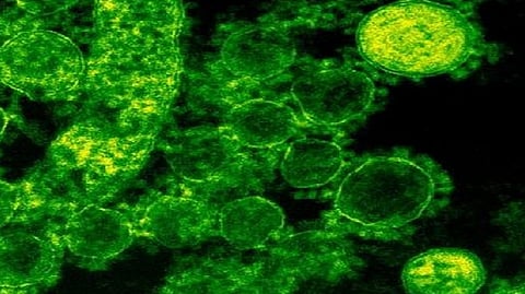 Representative Image