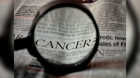 Representative image