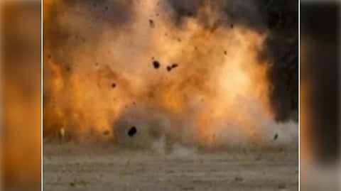 Representative Image