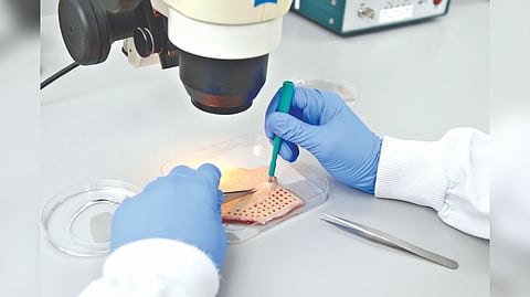 Representative image