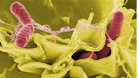 Representative Image