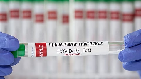 Representative image