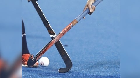 Representative image