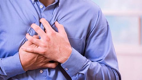 Representative Image