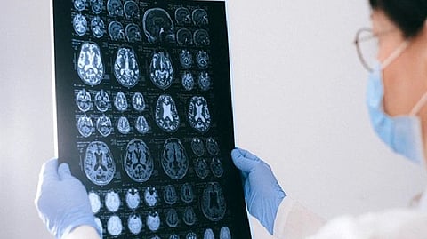 Representative Image