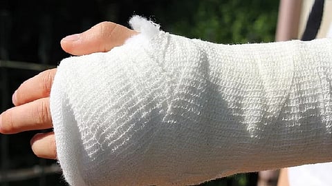 Representative Image