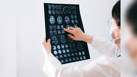 Representative Image