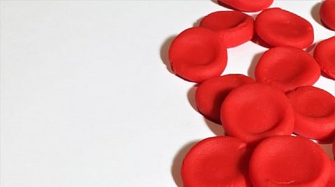 Representative image