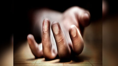 Representative image