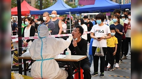 Representative image