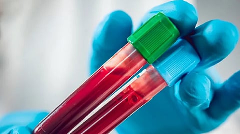 Representative Image