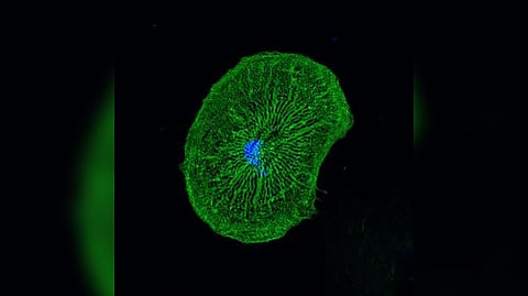 Representative image