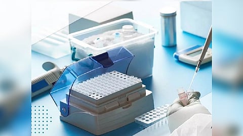 Representative image