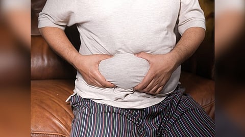 Representative Image