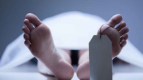 Representative image