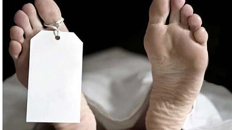 Representative image