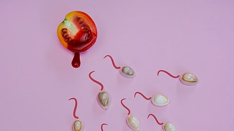 Representative image