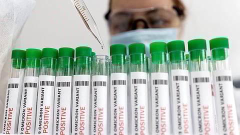 Representative Image