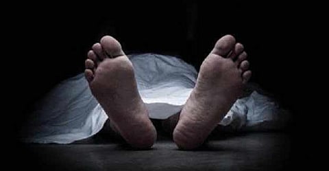 Representative Image