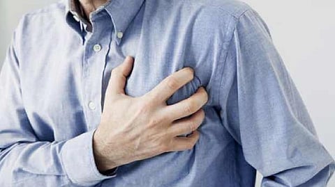 Representative image