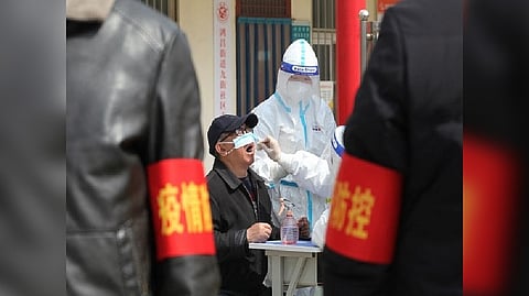 Representative image