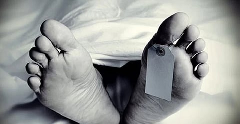 Representative Image