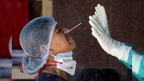 Representative Image