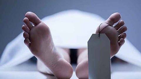 Representative image