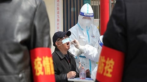 Representative image