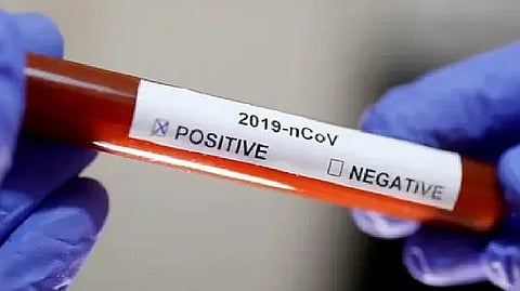 Representative image