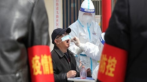 Representative Image